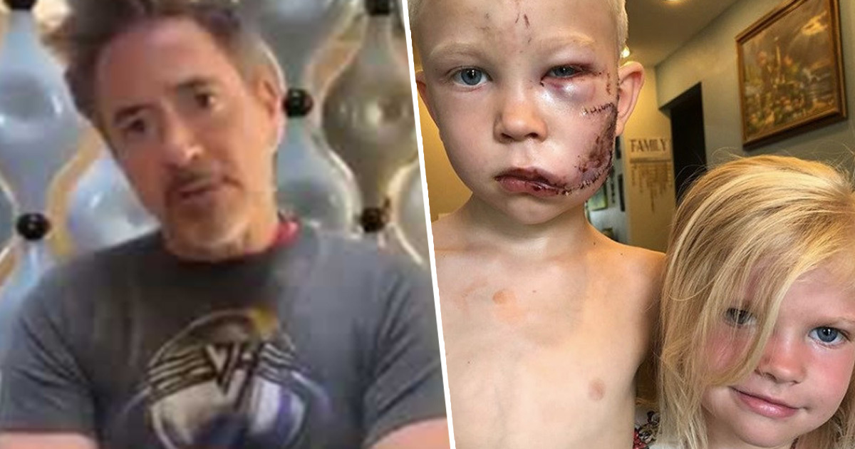 Robert Downey Jr. Sends Message To Hero Boy Who Saved Sister In Dog Attack - UNILAD